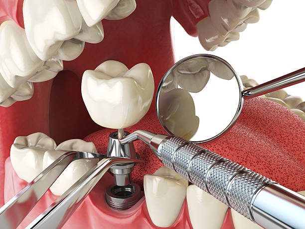 Best Emergency Treatment for Jaw Pain or Injury in Cornwells Heights, PA